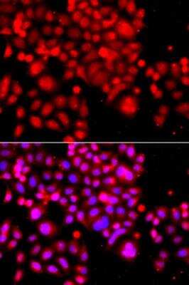 Immunocytochemistry/Immunofluorescence: ASCC3 Antibody [NBP2-92682] - Immunofluorescence analysis of A549 cells using ASCC3 antibody. Blue: DAPI for nuclear staining.