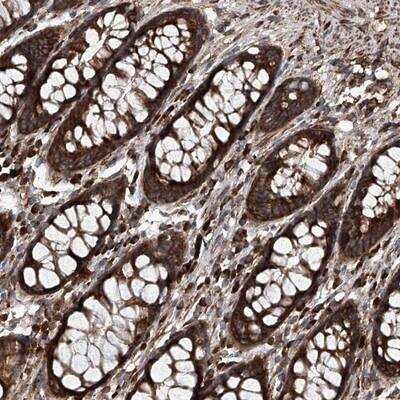 Immunohistochemistry: ASCC3 Antibody [NBP1-88853] - Staining of human rectum shows strong cytoplasmic positivity in glandular cells.