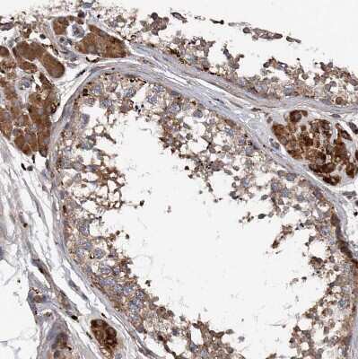 Immunohistochemistry-Paraffin: ASCC3 Antibody [NBP1-88829] - Staining of human testis shows moderate to strong cytoplasmic positivity in Leydig cells.