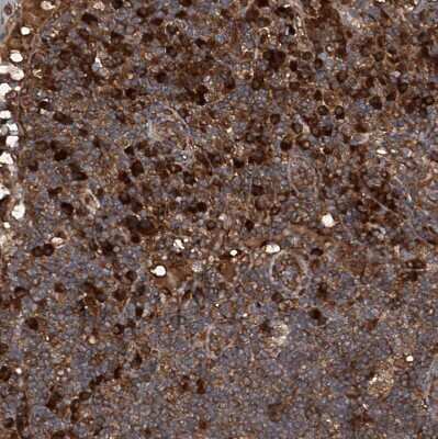 Immunohistochemistry-Paraffin: ASCC3 Antibody [NBP1-88829] - Staining of human lymph node shows moderate to strong cytoplasmic positivity in lymphoid cells.