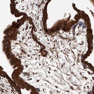 Immunohistochemistry-Paraffin: ASCC3 Antibody [NBP1-88829] - Staining of human placenta shows moderate to strong cytoplasmic positivity in trophoblastic cells.