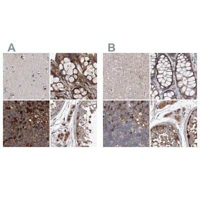 Immunohistochemistry-Paraffin: ASCC3 Antibody [NBP1-88829] - Staining of human cerebral cortex, colon, lymph node and testis using Anti-ASCC3 antibody NBP1-88829 (A) shows similar protein distribution across tissues to independent antibody NBP1-88854 (B).