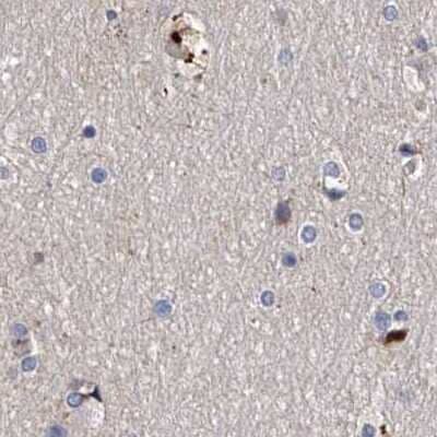 Immunohistochemistry-Paraffin: ASCC3 Antibody [NBP1-88829] - Staining of human cerebral cortex.