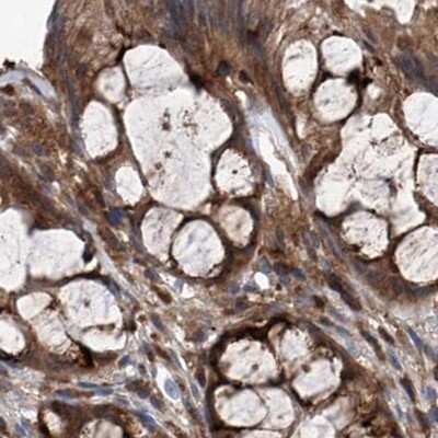 Immunohistochemistry-Paraffin: ASCC3 Antibody [NBP1-88829] - Staining of human colon.