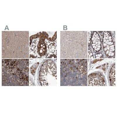 <b>Independent Antibodies Validation. </b>Immunohistochemistry-Paraffin: ASCC3 Antibody [NBP1-88853] - Staining of human cerebral cortex, colon, lymph node and testis using Anti-ASCC3 antibody NBP1-88853 (A) shows similar protein distribution across tissues to independent antibody NBP1-88854 (B).