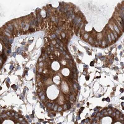 Immunohistochemistry-Paraffin: ASCC3 Antibody [NBP1-88853] - Staining of human colon.