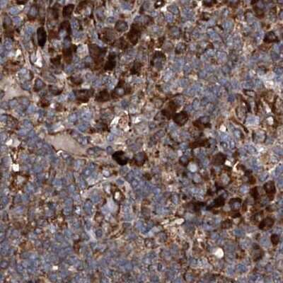 Immunohistochemistry-Paraffin: ASCC3 Antibody [NBP1-88853] - Staining of human lymph node.