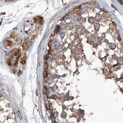 Immunohistochemistry-Paraffin: ASCC3 Antibody [NBP1-88853] - Staining of human testis.