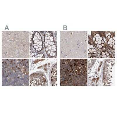 Immunohistochemistry-Paraffin: ASCC3 Antibody [NBP1-88854] - Staining of human cerebral cortex, colon, lymph node and testis using Anti-ASCC3 antibody NBP1-88854 (A) shows similar protein distribution across tissues to independent antibody NBP1-88829 (B).