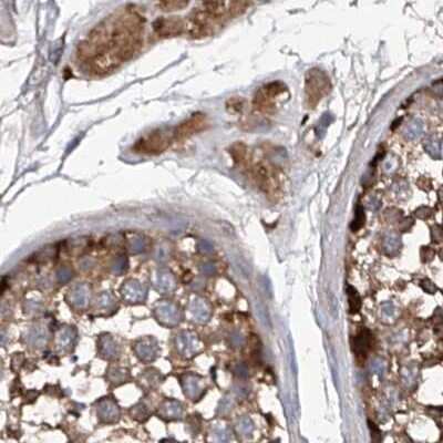 Immunohistochemistry-Paraffin: ASCC3 Antibody [NBP1-88854] - Staining of human testis.