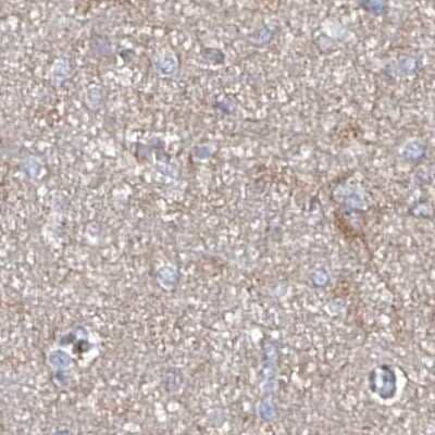 Immunohistochemistry-Paraffin: ASCC3 Antibody [NBP1-88854] - Staining of human cerebral cortex.