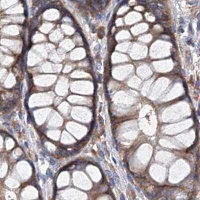 Immunohistochemistry-Paraffin: ASCC3 Antibody [NBP1-88854] - Staining of human colon.