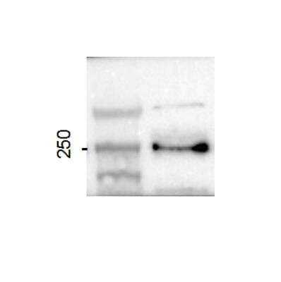 Western Blot: ASCC3 Antibody [NBP1-88829] - Western blot analysis of human skeletal muscle cell lysate (right lane). MWM in right lane (kDa). Western blot image submitted by a verified customer review.