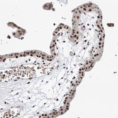 Immunohistochemistry-Paraffin: ASCC3L1 Antibody [NBP1-90086] - Staining of human placenta shows strong nuclear positivity in trophoblastic cells.
