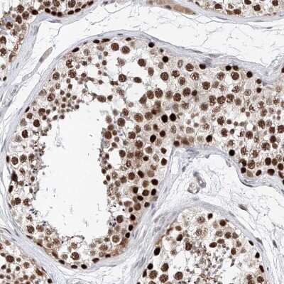 Immunohistochemistry-Paraffin: ASCC3L1 Antibody [NBP1-90086] - Staining of human testis shows strong nuclear positivity in cells in seminiferous ducts.