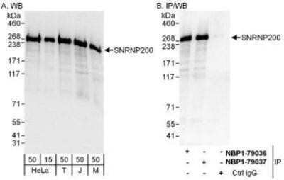 Western Blot ASCC3L1 Antibody