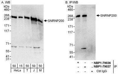Western Blot ASCC3L1 Antibody - BSA Free