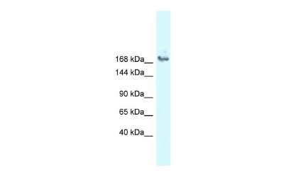 Western Blot: ASCC3L1 Antibody [NBP2-87044] - WB Suggested Anti-SNRNP200 Antibody. Titration: 1.0 ug/ml. Positive Control: COLO205 Whole Cell