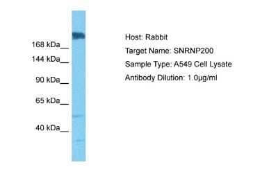 Western Blot: ASCC3L1 Antibody [NBP2-87044] - Host: Rabbit. Target Name: SNRNP200. Sample Tissue: Human A549 Whole Cell. Antibody Dilution: 1ug/ml