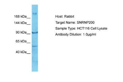Western Blot: ASCC3L1 Antibody [NBP2-87044] - Host: Rabbit. Target Name: SNRNP200. Sample Tissue: Human HCT116 Whole Cell. Antibody Dilution: 1ug/ml