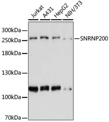 Western Blot: ASCC3L1 Antibody [NBP2-92466] - Analysis of extracts of various cell lines, using ASCC3L1 at 1:3000 dilution. Secondary antibody: HRP Goat Anti-Rabbit IgG (H+L) at 1:10000 dilution. Lysates/proteins: 25ug per lane. Blocking buffer: 3% nonfat dry milk in TBST. Detection: ECL Basic Kit . Exposure time: 90s.