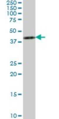 Western Blot: ASCL1/Mash1 Antibody (3D3) [H00000429-M03] - Analysis of ASCL1 expression in C32 (Cat # L002V1).