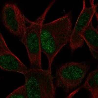 Immunocytochemistry/Immunofluorescence: ASCL1/Mash1 Antibody [NBP3-17687] - Staining of human cell line SH-SY5Y shows localization to nucleoplasm.