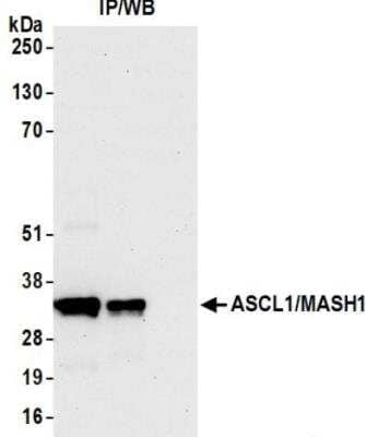 Immunoprecipitation ASCL1/Mash1 Antibody (BLR164J)