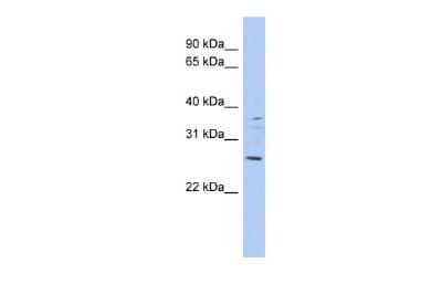 Western Blot: ASCL2/Mash2 Antibody [NBP2-83940] - WB Suggested Anti-ASCL2 Antibody Titration: 0.2-1 ug/ml. ELISA Titer: 1:312500. Positive Control: DU145 cell lysate