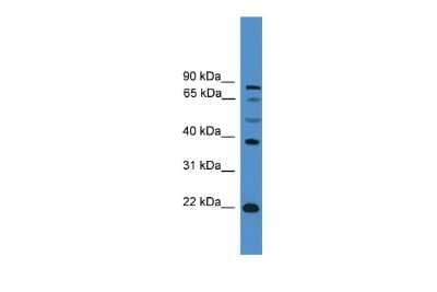 Western Blot: ASCL2/Mash2 Antibody [NBP2-83941] - WB Suggested Anti-ASCL2 Antibody Titration: 0.2-1 ug/ml. ELISA Titer: 1:312500. Positive Control: PANC1 cell lysateASCL2 is supported by BioGPS gene expression data to be expressed in PANC1