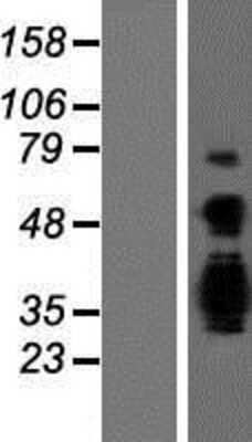 Western Blot: ASCL3 Overexpression Lysate (Adult Normal) [NBP2-06627] Left-Empty vector transfected control cell lysate (HEK293 cell lysate); Right -Over-expression Lysate for ASCL3.