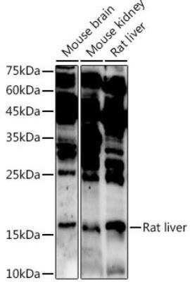 Western Blot: ASCL4 Antibody [NBP2-92741] - Analysis of extracts of various cell lines, using ASCL4 antibody at 1:1000 dilution.Secondary antibody: HRP Goat Anti-Rabbit IgG (H+L) at 1:10000 dilution.Lysates/proteins: 25ug per lane. Blocking buffer: 3% nonfat dry milk in TBST.Detection: ECL Enhanced Kit. Exposure time: 180s.