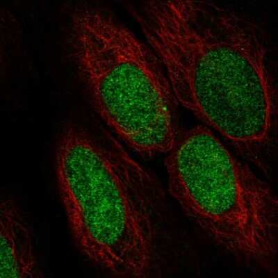 Immunocytochemistry/Immunofluorescence: ASF1a Antibody [NBP2-57504] - Staining of human cell line U-2 OS shows localization to nucleoplasm.