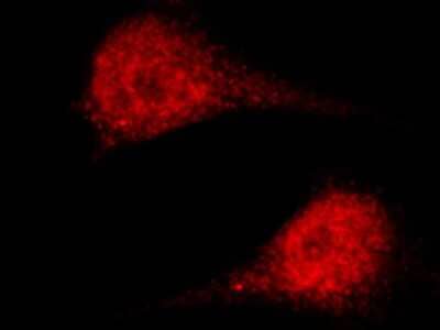 Immunocytochemistry/Immunofluorescence: ASF1a Antibody [NBP2-98775] - Immunofluorescence staining of ASF1a in HeLa cells. Cells were fixed with 4% PFA, permeabilzed with 0.3% Triton X-100 in PBS, blocked with 10% serum, and incubated with rabbit anti-human ASF1a polyclonal antibody (1:1000) at 4C overnight. Then cells were stained with the Alexa Fluor(R)594-conjugated Goat Anti-rabbit IgG secondary antibody (red). Positive staining was localized to nucleus.