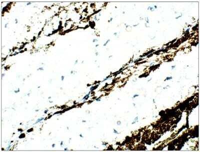 Immunohistochemistry-Paraffin ASF1a Antibody