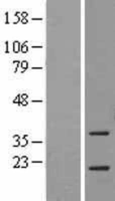 Western Blot: ASF1a Overexpression Lysate (Adult Normal) [NBL1-07760] Left-Empty vector transfected control cell lysate (HEK293 cell lysate); Right -Over-expression Lysate for ASF1a.