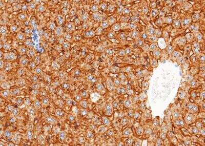 Immunohistochemistry-Paraffin: ASGPR1 Antibody (114) [NBP2-90400] - Staining of mouse ASGR1 in mouse liver with rabbit monoclonal antibody (1:500).