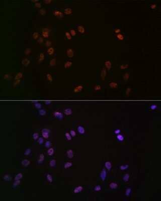 Immunocytochemistry/Immunofluorescence: ASH2L Antibody (10B6U5) [NBP3-16505] - Immunofluorescence analysis of C6 cells using ASH2L Rabbit mAb (NBP3-16505) at dilution of 1:100 (40x lens). Blue: DAPI for nuclear staining.