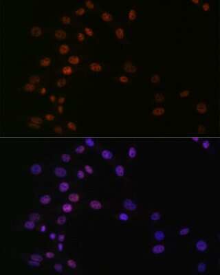 Immunocytochemistry/Immunofluorescence: ASH2L Antibody (10B6U5) [NBP3-16505] - Immunofluorescence analysis of NIH-3T3 cells using ASH2L Rabbit mAb (NBP3-16505) at dilution of 1:100 (40x lens). Blue: DAPI for nuclear staining.