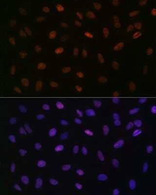 Immunocytochemistry/Immunofluorescence: ASH2L Antibody (10B6U5) [NBP3-16505] - Immunofluorescence analysis of U-2 OS cells using ASH2L Rabbit mAb (NBP3-16505) at dilution of 1:100 (40x lens). Blue: DAPI for nuclear staining.