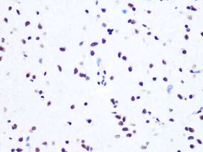 Immunohistochemistry-Paraffin: ASH2L Antibody (10B6U5) [NBP3-16505] - Rat brain using ASH2L Rabbit mAb (NBP3-16505) at dilution of 1:100 (40x lens).Perform microwave antigen retrieval with 10 mM PBS buffer pH 7.2 before commencing with IHC staining protocol.