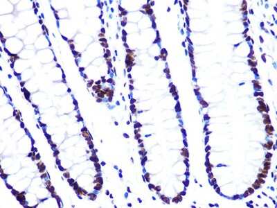 Immunohistochemistry-Paraffin: ASH2L Antibody (10B6U5) [NBP3-16505] - Human colon using ASH2L Rabbit mAb (NBP3-16505) at dilution of 1:100 (40x lens).Perform microwave antigen retrieval with 10 mM PBS buffer pH 7.2 before commencing with IHC staining protocol.