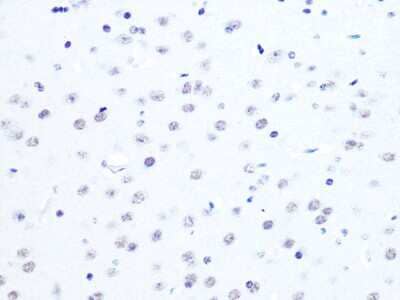 Immunohistochemistry-Paraffin: ASH2L Antibody (10B6U5) [NBP3-16505] - Mouse brain using ASH2L Rabbit mAb (NBP3-16505) at dilution of 1:100 (40x lens).Perform microwave antigen retrieval with 10 mM PBS buffer pH 7.2 before commencing with IHC staining protocol.