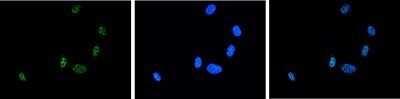 Immunocytochemistry/Immunofluorescence: ASH2L Antibody [NBP2-59292] - NIH3T3 cells were stained with the antibody against Ash2 and with DAPI. Cells were fixed with 4% formaldehyde for 10 minutes and blocked with PBS/TX-100 containing 5% normal goat serum and 1% BSA. The cells were immunofluorescently labelled with the Ash2 antibody (left) diluted 1:200 in blocking solution followed by an anti-rabbit antibody conjugated to Alexa Fluor 488. The middle panel shows staining of the nuclei with DAPI. A merge of the two stainings is shown on the right.