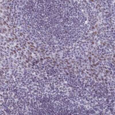 Immunohistochemistry-Paraffin: ASH2L Antibody [NBP1-88858] - Staining of human tonsil shows nuclear positivity in non-germinal center.