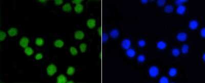 Immunocytochemistry/Immunofluorescence: ASH2L Antibody (ST47-01) [NBP2-67500] - Staining ASH2L in CRC cells (green). Cells were fixed in paraformaldehyde, permeabilised with 0.25% Triton X100/PBS.