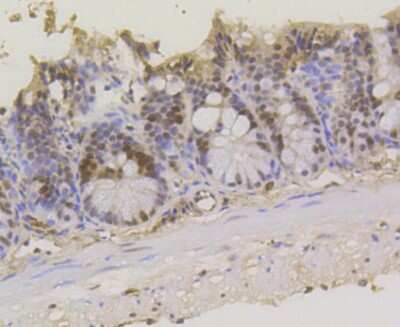 Immunohistochemistry-Paraffin: ASH2L Antibody (ST47-01) [NBP2-67500] - Analysis of paraffin-embedded mouse colon tissue using anti-ASH2L antibody. Counter stained with hematoxylin.