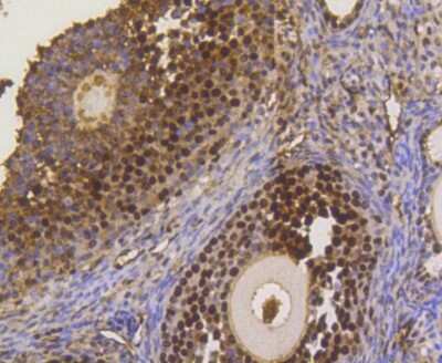 Immunohistochemistry-Paraffin: ASH2L Antibody (ST47-01) [NBP2-67500] - Analysis of paraffin-embedded mouse ovary tissue using anti-ASH2L antibody. Counter stained with hematoxylin.