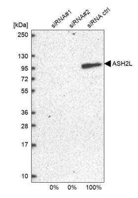 Western Blot: ASH2L Antibody [NBP1-88858] - Analysis in U2OS cells transfected with control siRNA, target specific siRNA probe #1 and #2. Remaining relative intensity is presented.