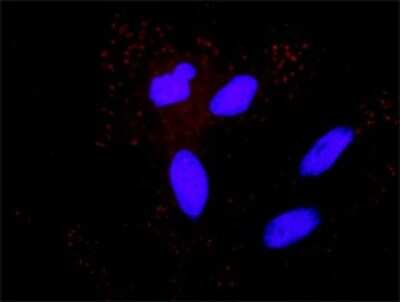 Proximity Ligation Assay: ASK1 Antibody [H00004217-D01P] - Analysis of protein-protein interactions between MAP3K5 and APP. HeLa cells were stained with anti-MAP3K5 rabbit purified polyclonal 1:1200 and anti-APP mouse monoclonal antibody 1:50. Each red dot represents the detection of protein-protein interaction complex, and nuclei were counterstained with DAPI (blue).